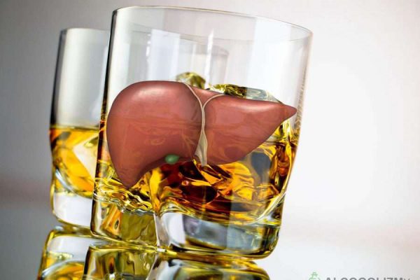 what is the cirrhosis of liver cancer