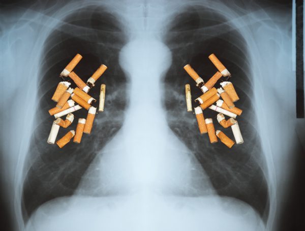 The effect of cigarettes on lungs