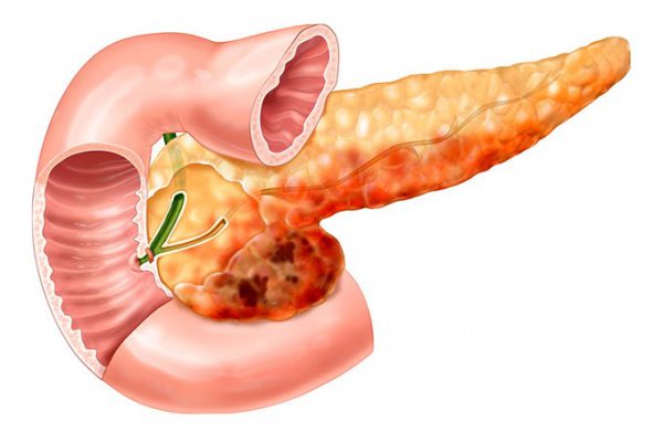 The effect of Smoking on the pancreas