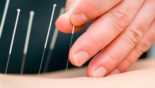 treatment for Smoking acupuncture