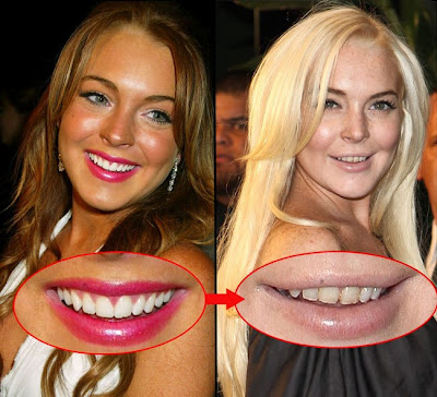 Note the teeth Lindsay Lohan and her appearance