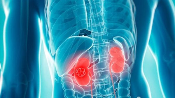 How Smoking affects the kidneys