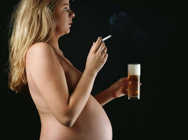 Alcohol syndrome in the fetus